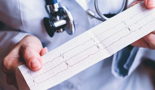 أعراض وأسباب بطء القلب التشخيص والعلاج