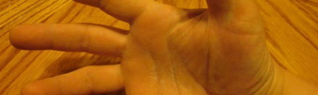 اضرار العاده السريه عند البنات قبل الزواج