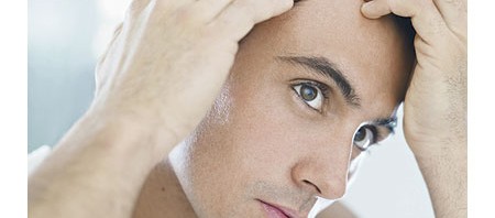 اسباب و علاج تساقط الشعر عند الرجال